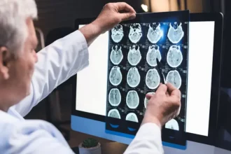 recent-legal-trends-for-brain-injury-cases-in-california